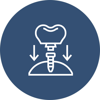 IMPLANTS