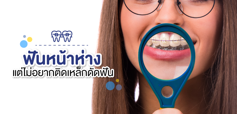 ฟันหน้าห่าง