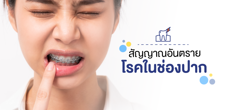 สัญญาณอันตราย