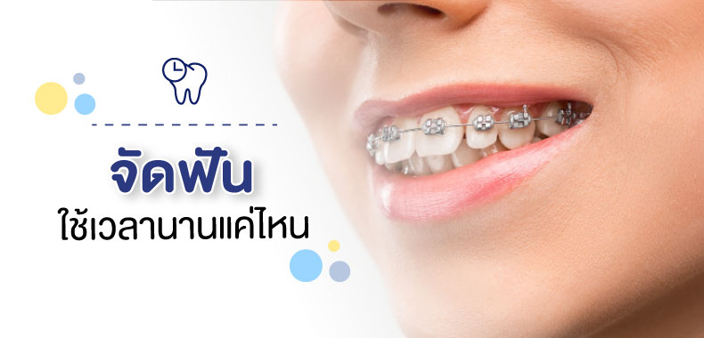 จัดฟัน ใช้เวลานานแค่ไหน